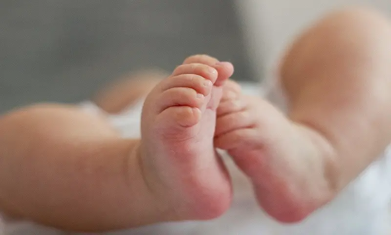 Clubfoot Relief